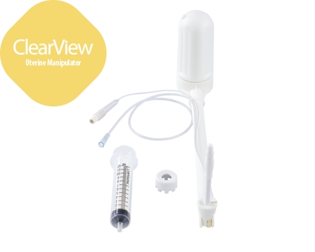 Manipolatore uterino con iniettore ClearView®